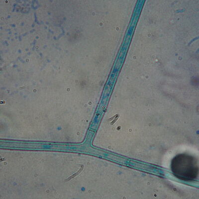 Thanatephorus cucumeris